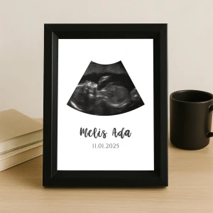 İsimli ve Tarihli Tek Fotoğraflı Ultrason Çerçevesi - 15x21 cm